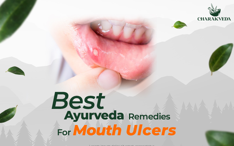 ayurvedic-medicine-for-mouth-ulcer