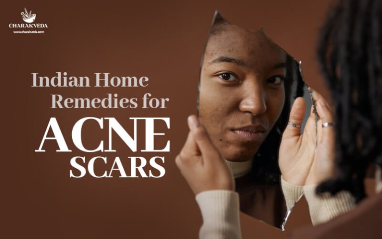 ACNE SCARS