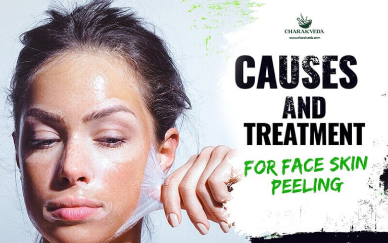 Dealing with Face Skin Peeling? Find out what’s causing it and the easy treatment options